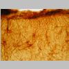 Astroglia GFAP 03.jpg